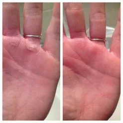 Burpee Callus Killer Kit Shaver -Udstyr og tilbehør butik 1033 07.MASTER Burpee Callus Killer Kit Shaver 0223